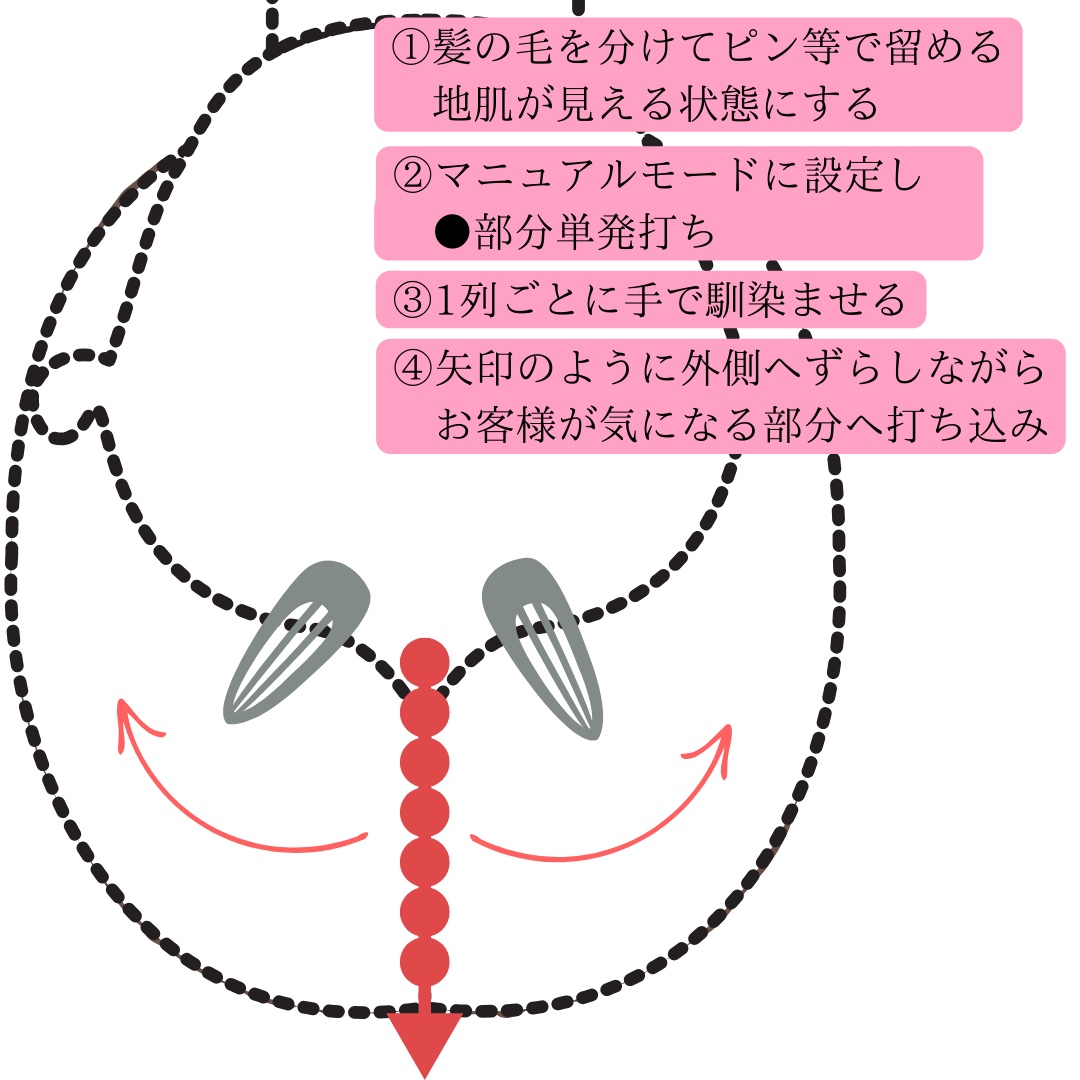 頭皮への施術方法